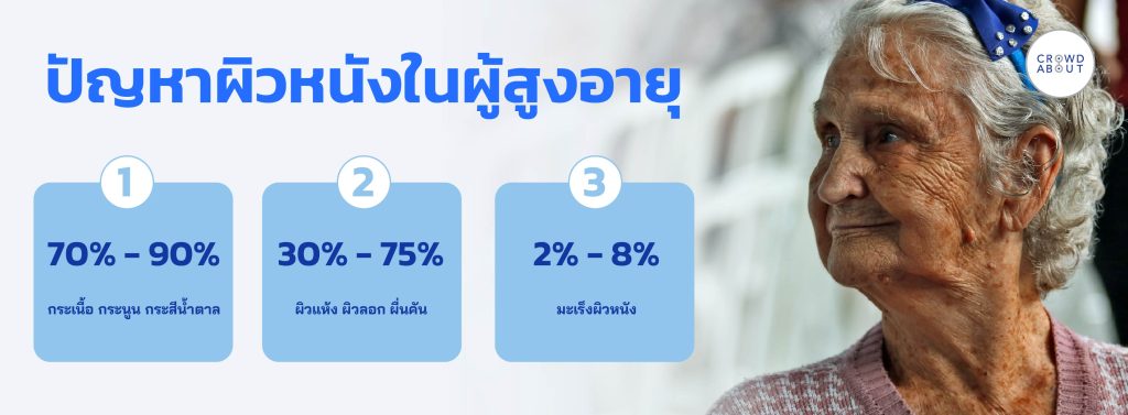 ปัญหาผิวหนังผู้สูงอายุ